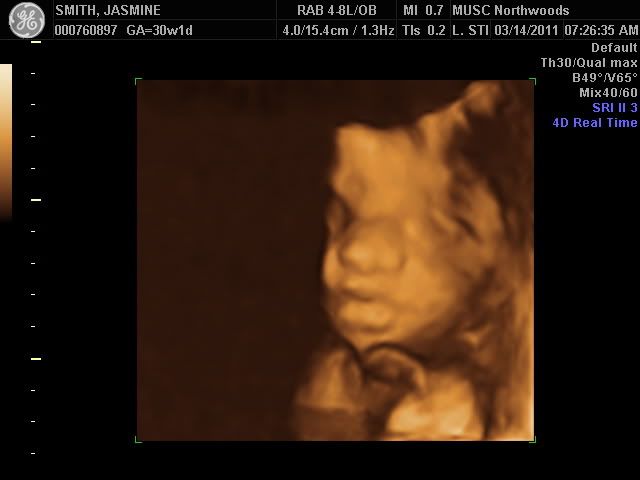 3D/4D Ultrasound at 27 weeks. - BabyGaga