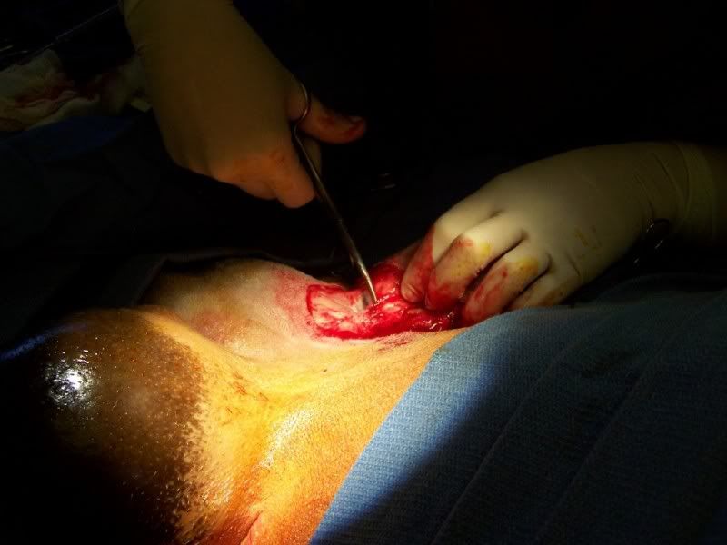 Mastitis : Buck Mastectomy/Milking buck - Health & Wellness